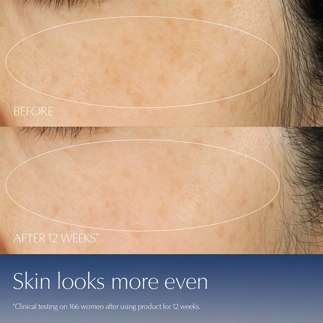 ๐ๆฐๅไธๆถใๆขจ่ฑๅจใ็พๅ้้็๐Advanced Night Repai้
่ฉฉ่ญ้ปๅ
จๆนไฝไฟฎ่ญท้ฒๅฐๆฃ็ถ(50ml*2ๅ
ฅๅชๆ ็ต)